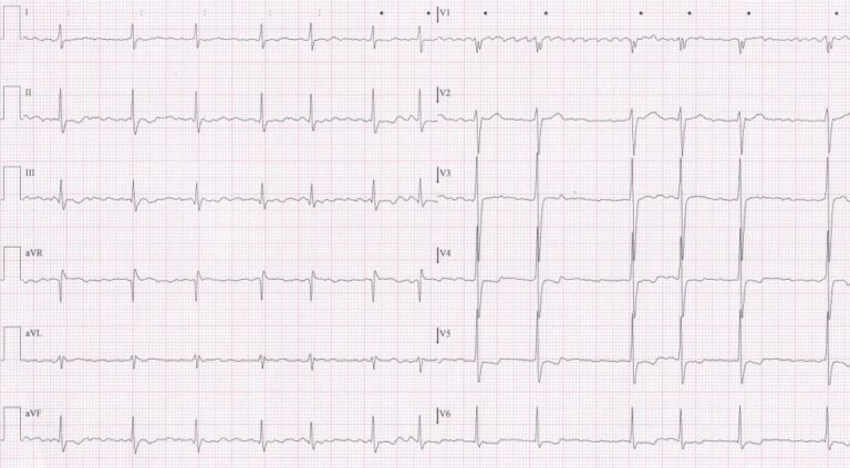 ecg-test1