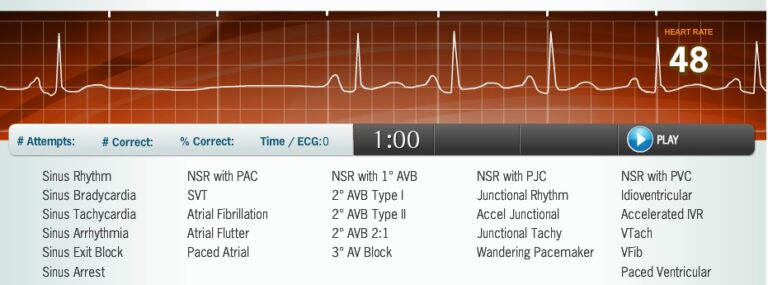 ecg_simulator