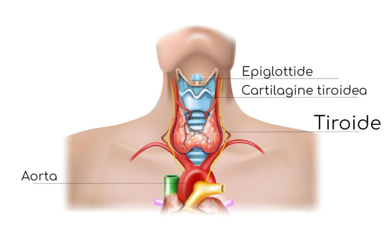 tiroide