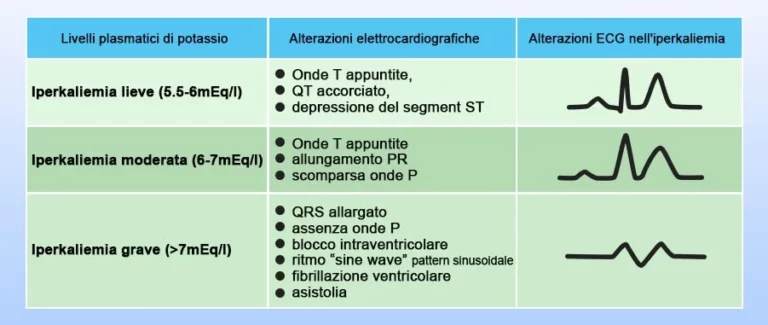 alterazioni-elettrocardiografiche-article-thumbnail-size.jpg